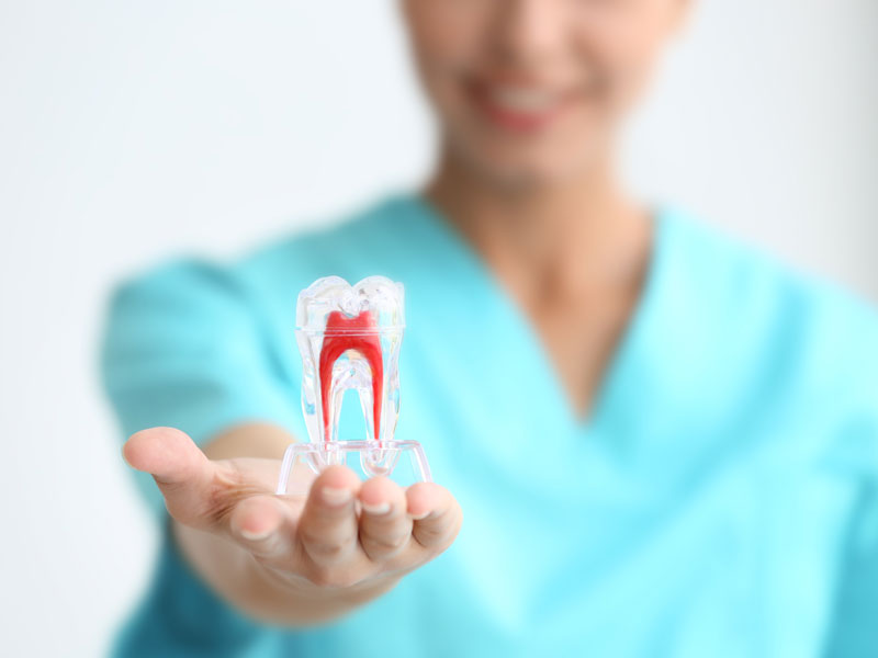 Root Canals